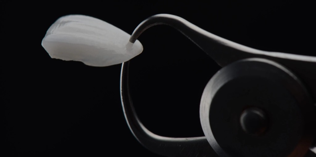 Digital Smile Design Process at Anish Dental Clinic Satara